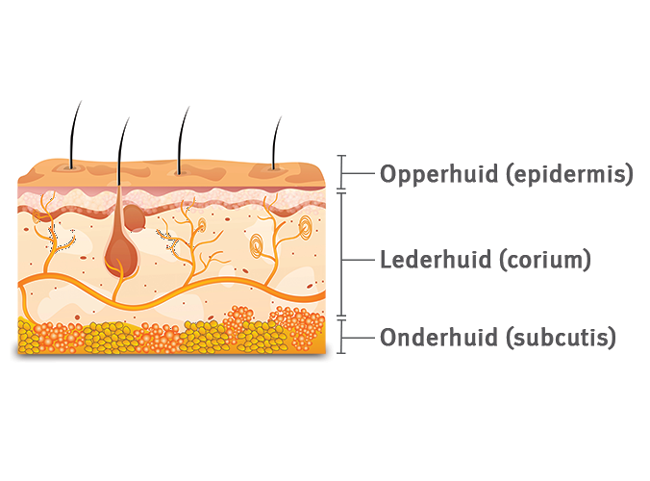 onder en opperhuid